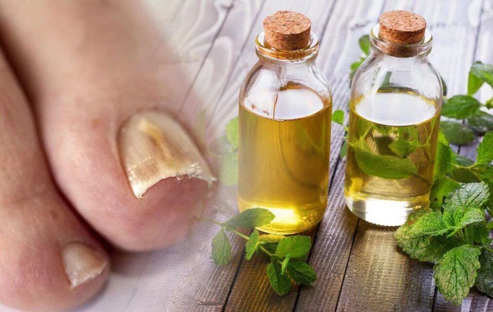 vinegar for toenail fungus